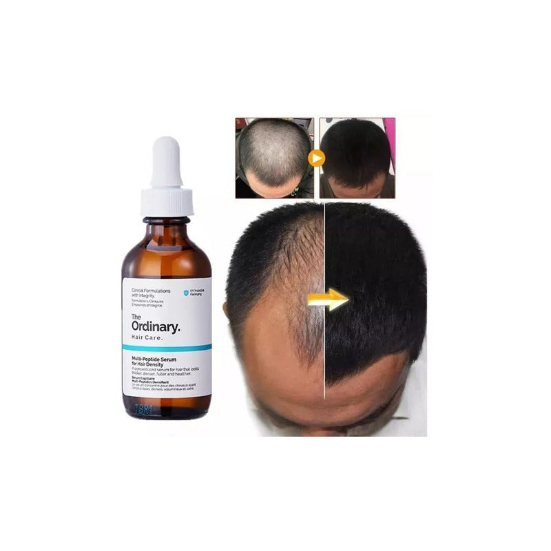 The Ordinary Multi-peptide Serum For Hair Density 60 Ml